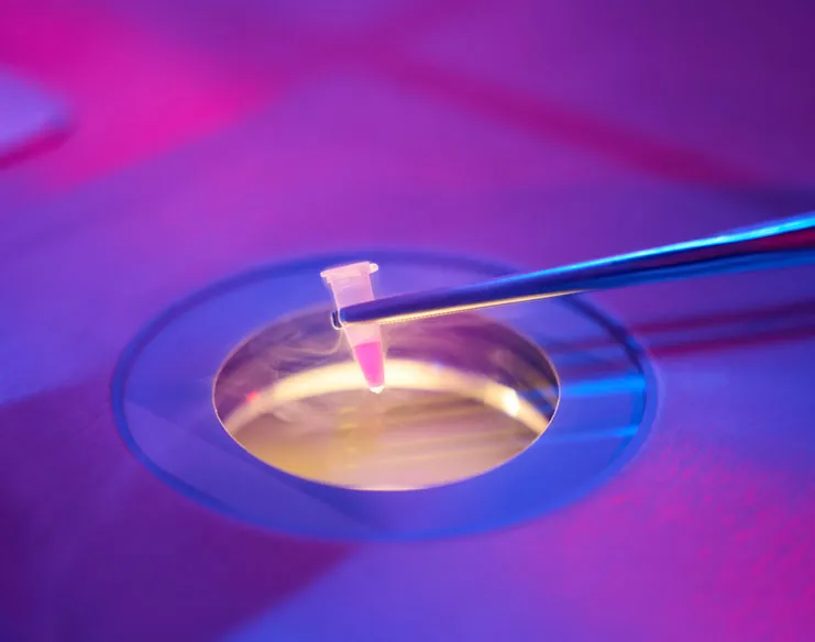 Elective Egg Freezing in Your Early 30s: Things to Consider