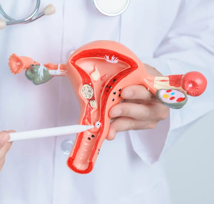 A doctor pointing to an anatomical model of the female reproductive system.