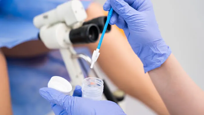 A gloved doctor collecting a cervical swab sample into a specimen container.