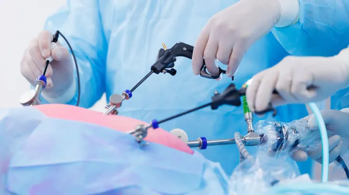 Surgeons performing a laparoscopic procedure using minimally invasive instruments.