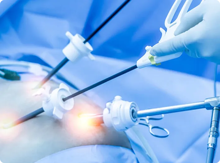 Surgeons performing a laparoscopic procedure using minimally invasive instruments.